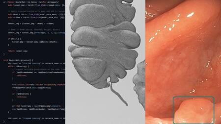 eHealth: Coden und KI in der Gastroenterologie & wo bislang der Durchbruch fehlt